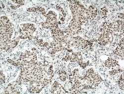 RBM15 Rabbit anti-Human, Mouse, Rat, Polyclonal, Proteintech 150 &mu;L;