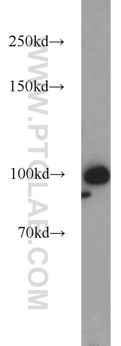 RBM15 Rabbit anti-Human, Mouse, Rat, Polyclonal, Proteintech 150 &mu;L;