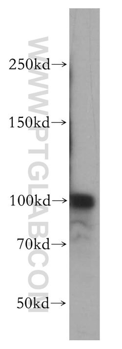 RBM15 Rabbit anti-Human, Mouse, Rat, Polyclonal, Proteintech 150 &mu;L;
