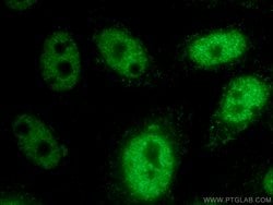 HEY2 Rabbit anti-Human, Mouse, Rat, Polyclonal, Proteintech 150 &mu;L;