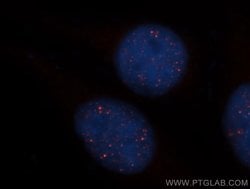 HEY2 Rabbit anti-Human, Mouse, Rat, Polyclonal, Proteintech 150 &mu;L;