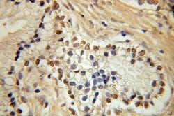HEY2 Rabbit anti-Human, Mouse, Rat, Polyclonal, Proteintech 150 &mu;L;