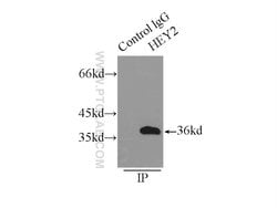 HEY2 Rabbit anti-Human, Mouse, Rat, Polyclonal, Proteintech 150 &mu;L;