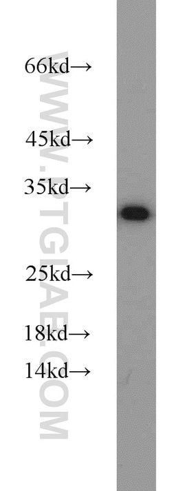 HEY2 Rabbit anti-Human, Mouse, Rat, Polyclonal, Proteintech 150 &mu;L;