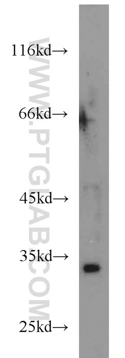 HEY2 Rabbit anti-Human, Mouse, Rat, Polyclonal, Proteintech 150 &mu;L;
