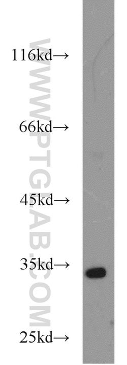 HEY2 Rabbit anti-Human, Mouse, Rat, Polyclonal, Proteintech 150 &mu;L;