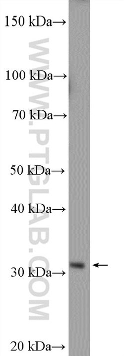 HEY2 Rabbit anti-Human, Mouse, Rat, Polyclonal, Proteintech 150 &mu;L;