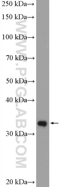 HEY2 Rabbit anti-Human, Mouse, Rat, Polyclonal, Proteintech 150 &mu;L;