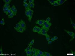 Plexin B2 Rabbit anti-Human, Mouse, Rat, Polyclonal, Proteintech 150 &mu;L;