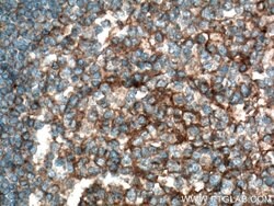 Plexin B2 Rabbit anti-Human, Mouse, Rat, Polyclonal, Proteintech 150 &mu;L;