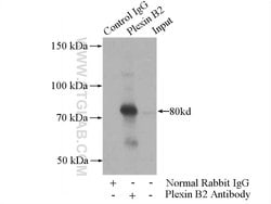 Plexin B2 Rabbit anti-Human, Mouse, Rat, Polyclonal, Proteintech 150 &mu;L;