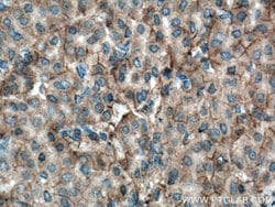 Plexin B2 Rabbit anti-Human, Mouse, Rat, Polyclonal, Proteintech 150 &mu;L;