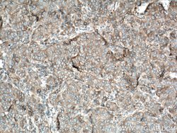 Plexin B2 Rabbit anti-Human, Mouse, Rat, Polyclonal, Proteintech 150 &mu;L;