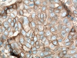 Plexin B2 Rabbit anti-Human, Mouse, Rat, Polyclonal, Proteintech 150 &mu;L;