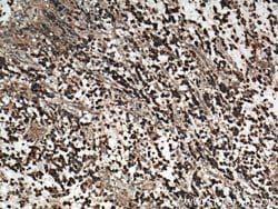 Plexin B2 Rabbit anti-Human, Mouse, Rat, Polyclonal, Proteintech 150 &mu;L;