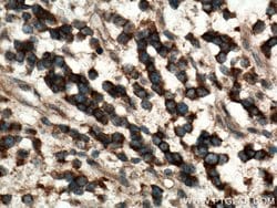 Plexin B2 Rabbit anti-Human, Mouse, Rat, Polyclonal, Proteintech 150 &mu;L;