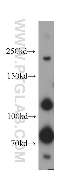 Plexin B2 Rabbit anti-Human, Mouse, Rat, Polyclonal, Proteintech 150 &mu;L;