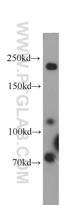 Plexin B2 Rabbit anti-Human, Mouse, Rat, Polyclonal, Proteintech 150 &mu;L;