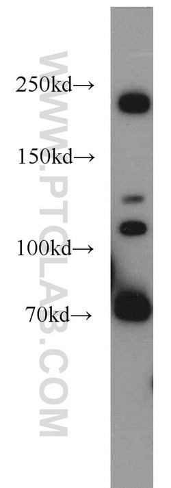 Plexin B2 Rabbit anti-Human, Mouse, Rat, Polyclonal, Proteintech 150 &mu;L;