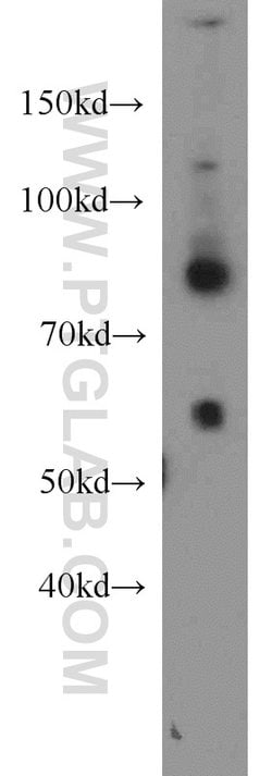 Plexin B2 Rabbit anti-Human, Mouse, Rat, Polyclonal, Proteintech 150 &mu;L;