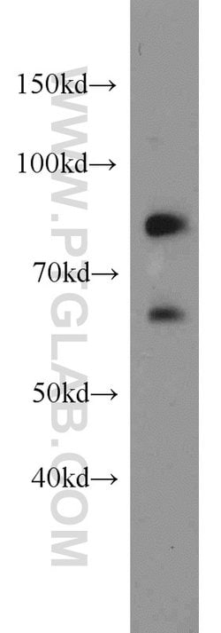 Plexin B2 Rabbit anti-Human, Mouse, Rat, Polyclonal, Proteintech 150 &mu;L;