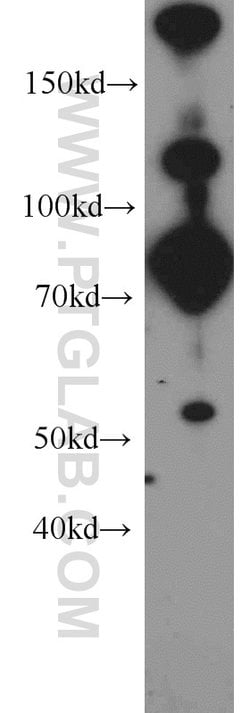 Plexin B2 Rabbit anti-Human, Mouse, Rat, Polyclonal, Proteintech 150 &mu;L;