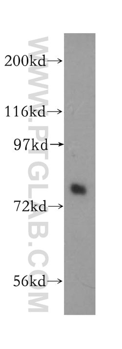 Plexin B2 Rabbit anti-Human, Mouse, Rat, Polyclonal, Proteintech 150 &mu;L;