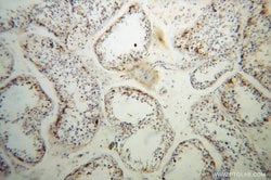 IFT81 Rabbit anti-Human, Mouse, Rat, Polyclonal, Proteintech:Antibodies:Primary