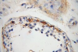 IFT81 Rabbit anti-Human, Mouse, Rat, Polyclonal, Proteintech:Antibodies:Primary