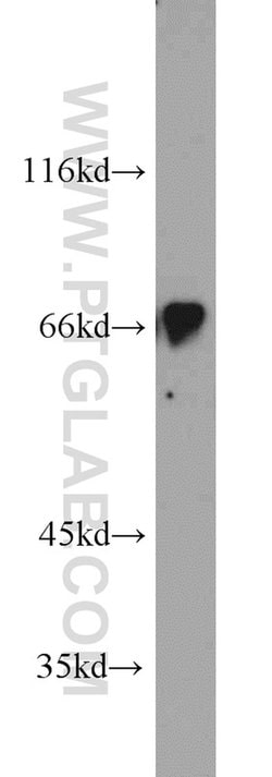 IFT81 Rabbit anti-Human, Mouse, Rat, Polyclonal, Proteintech:Antibodies:Primary