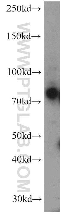 IFT81 Rabbit anti-Human, Mouse, Rat, Polyclonal, Proteintech:Antibodies:Primary