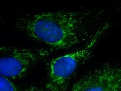 CHRNA1 Rabbit anti-Human, Mouse, Rat, Polyclonal, Proteintech:Antibodies:Primary