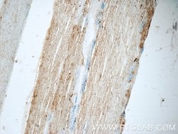 CHRNA1 Rabbit anti-Human, Mouse, Rat, Polyclonal, Proteintech:Antibodies:Primary