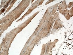 CHRNA1 Rabbit anti-Human, Mouse, Rat, Polyclonal, Proteintech:Antibodies:Primary