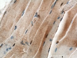 CHRNA1 Rabbit anti-Human, Mouse, Rat, Polyclonal, Proteintech:Antibodies:Primary