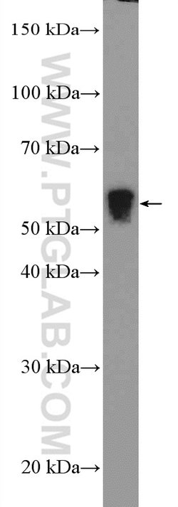 CHRNA1 Rabbit anti-Human, Mouse, Rat, Polyclonal, Proteintech:Antibodies:Primary