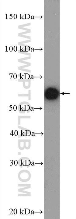 CHRNA1 Rabbit anti-Human, Mouse, Rat, Polyclonal, Proteintech:Antibodies:Primary