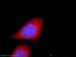 UFD1L Rabbit anti-Human, Mouse, Rat, Polyclonal, Proteintech:Antibodies:Primary