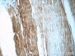 UFD1L Rabbit anti-Human, Mouse, Rat, Polyclonal, Proteintech:Antibodies:Primary