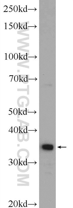 UFD1L Rabbit anti-Human, Mouse, Rat, Polyclonal, Proteintech:Antibodies:Primary