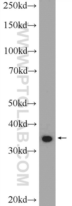 UFD1L Rabbit anti-Human, Mouse, Rat, Polyclonal, Proteintech:Antibodies:Primary
