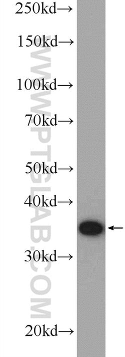 UFD1L Rabbit anti-Human, Mouse, Rat, Polyclonal, Proteintech:Antibodies:Primary