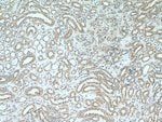 Thumbnail_SDHB Rabbit anti-Human, Mouse, Rat, Polyclonal, Proteintech 150 &mu;L;