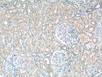 Thumbnail_SDHB Rabbit anti-Human, Mouse, Rat, Polyclonal, Proteintech 150 &mu;L;