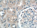 Thumbnail_SDHB Rabbit anti-Human, Mouse, Rat, Polyclonal, Proteintech 150 &mu;L;
