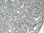 Thumbnail_SDHB Rabbit anti-Human, Mouse, Rat, Polyclonal, Proteintech 150 &mu;L;