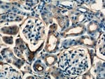Thumbnail_SDHB Rabbit anti-Human, Mouse, Rat, Polyclonal, Proteintech 150 &mu;L;