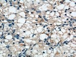 Thumbnail_SDHB Rabbit anti-Human, Mouse, Rat, Polyclonal, Proteintech 150 &mu;L;