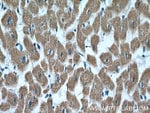 Thumbnail_SDHB Rabbit anti-Human, Mouse, Rat, Polyclonal, Proteintech 150 &mu;L;