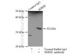 Thumbnail_SDHB Rabbit anti-Human, Mouse, Rat, Polyclonal, Proteintech 150 &mu;L;